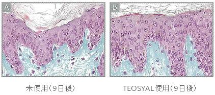06-teosyal_03.JPG